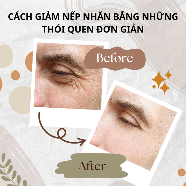 CÁCH GIẢM NẾP NHĂN BẰNG NHỮNG THÓI QUEN ĐƠN GIẢN TẠI NHÀ
