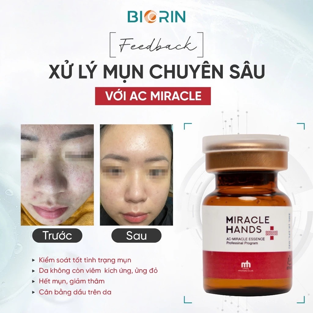 Meso mụn AC-Miracle Essence - Tinh chất ức chế đa vi khuẩn và vi nấm gây mụn - 3ml