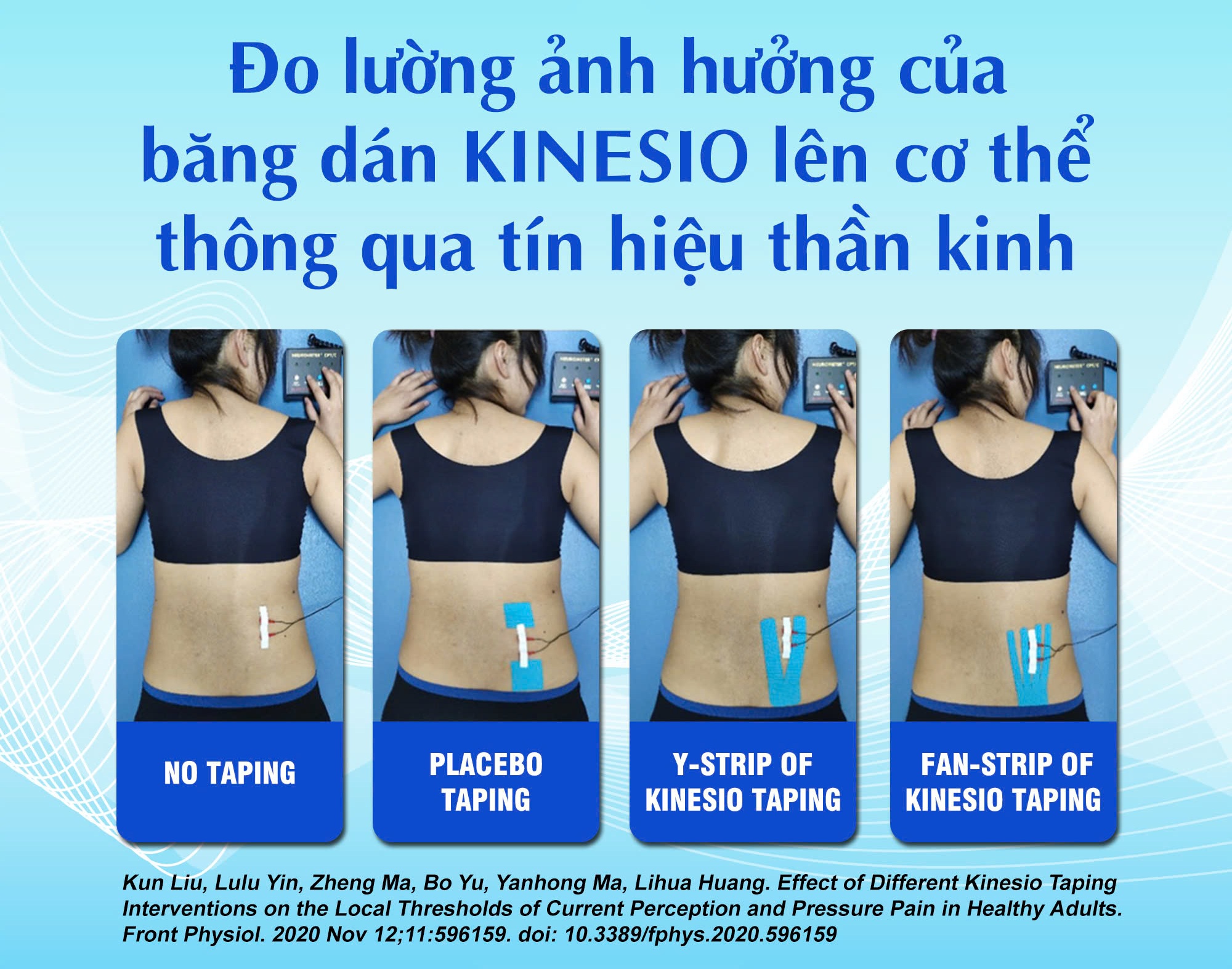 KINESIO TAPING CÓ THỰC SỰ TÁC ĐỘNG LÊN THẦN KINH NGOẠI VI NÔNG?