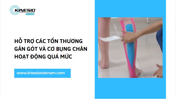 HƯỚNG DẪN CÁCH DÁN BĂNG KINESIO HỖ TRỢ GÂN GÓT VÀ CƠ BỤNG CHÂN