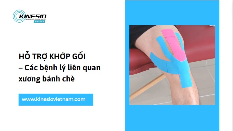 HƯỚNG DẪN CÁCH DÁN BĂNG KINESIO HỖ TRỢ KHỚP GỐI & XƯƠNG BÁNH CHÈ