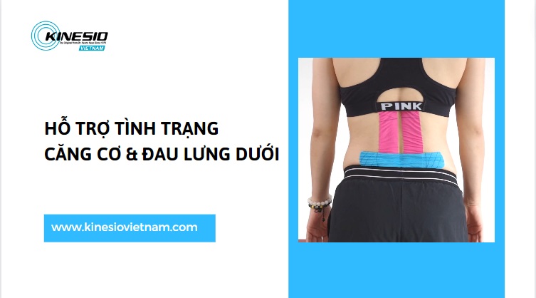 HƯỚNG DẪN CÁCH DÁN KINESIO HỖ TRỢ GIẢM ĐAU LƯNG DƯỚI