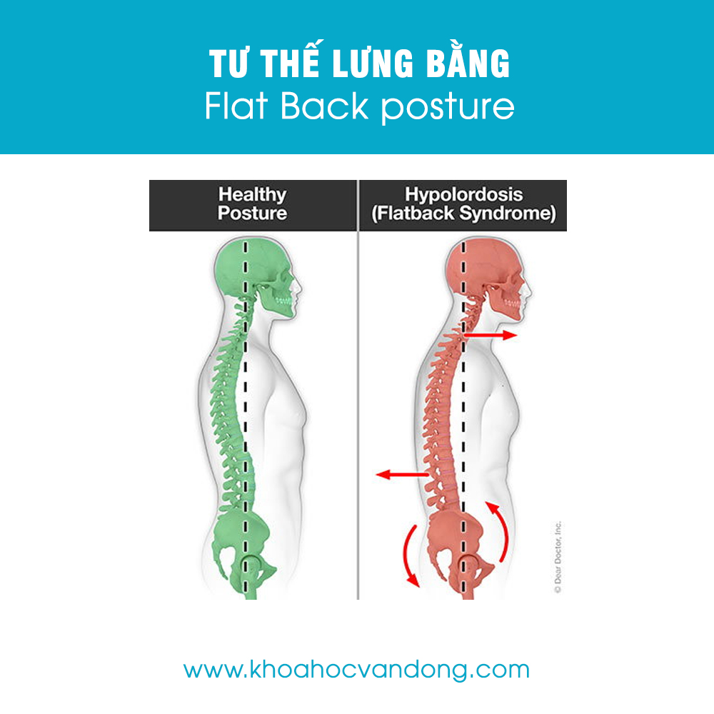 Tư thế lưng bằng