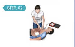 Đặt 2 miếng dán -Cách sử dụng máy huấn luyện sốc tim/khử rung tim - AED trainer