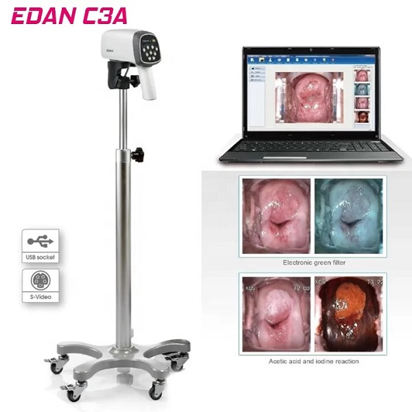 MÁY SOI CỔ TỬ CUNG EDAN C3A