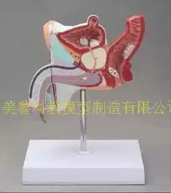 MÔ HÌNH GIẢNG DẠY BỆNH LÝ HỆ SINH DỤC NAM