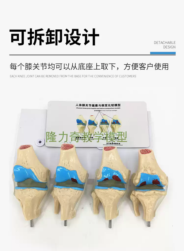 MÔ HÌNH GIẢNG DẠY BỆNH LÝ KHỚP GỐI