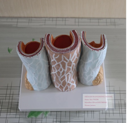 MÔ HÌNH CẤU TẠO THÀNH MẠCH