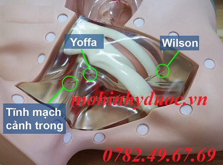 MÔ HÌNH ĐẶT CATHETER TĨNH MẠCH TRUNG TÂM