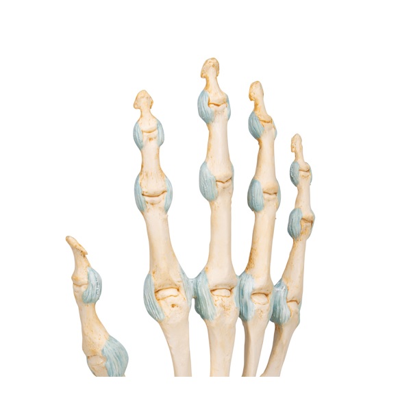 Anhvanyds  Hand Bone Age Tuổi xương bàn tay