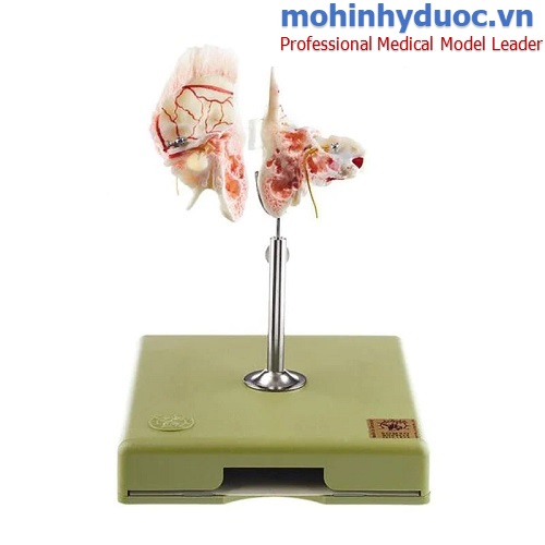 Mô hình xương thái dương 2 phần SOMSO