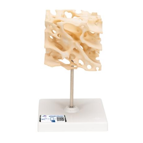 MÔ HÌNH XƯƠNG XỐP CỦA CON NGƯỜI, PHÓNG TO 100 LẦN