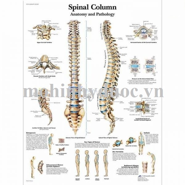 Tranh Giải Phẫu Cột Sống Phía Trước, Phía Sau – 1001480 – 3B Scientific