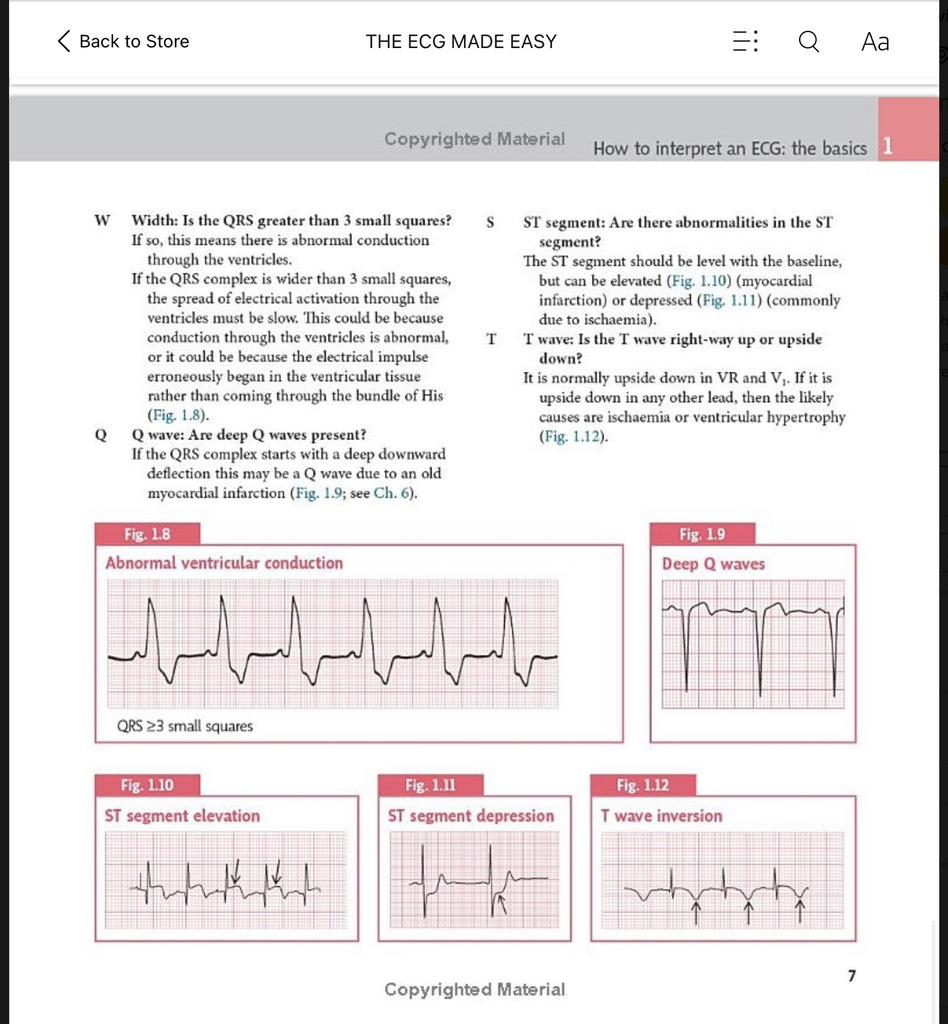 Easy Ecg Algorithm Sách ngoại văn The ECG Made Easy 9th