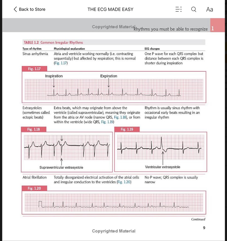 Easy Ecg Algorithm Sách ngoại văn The ECG Made Easy 9th