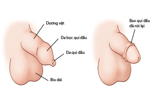 17 Tuổi Chưa Lột Bao Quy Đầu Có Sao Không?