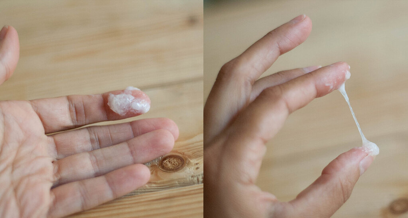Chất Nhầy Cổ Tử Cung Là Gì? Vai Trò, Sự Thay Đổi Theo Chu Kỳ Và Dấu Hiệu Bất Thường