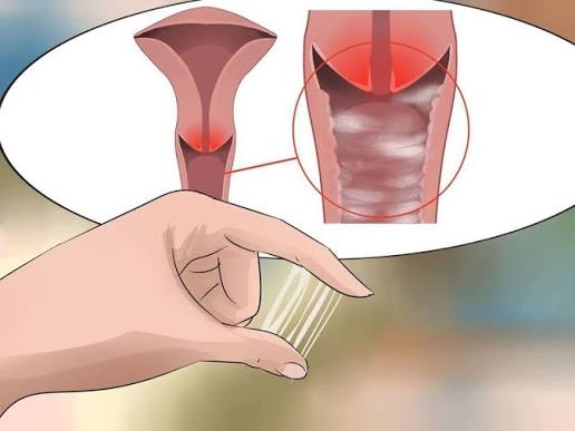 Chất Nhầy Cổ Tử Cung Là Gì? Vai Trò, Sự Thay Đổi Theo Chu Kỳ Và Dấu Hiệu Bất Thường