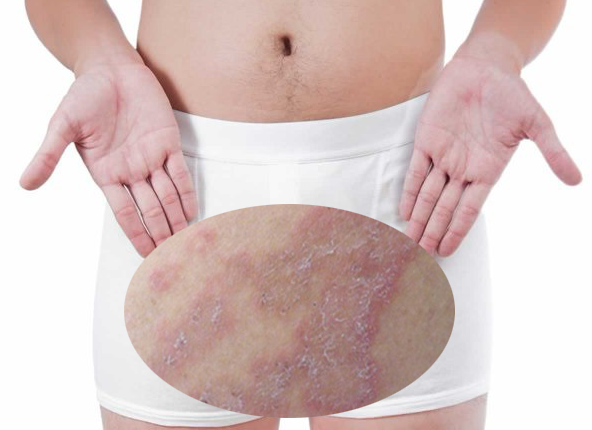 Đặt Tinh Hoàn Nhân Tạo Là Gì? Quy Trình, Hiệu Quả Và Mức Độ An Toàn Hiện Nay