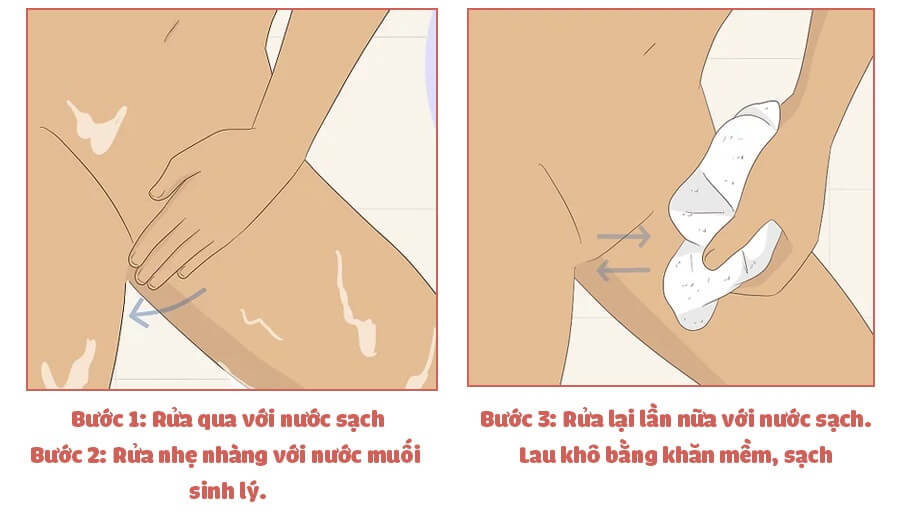 Hướng dẫn vệ sinh vùng kín cho "Cô bé" của bạn đúng cách