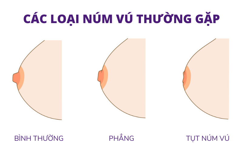Đàn ông thích nhũ hoa nhỏ hay to? Những kiểu nhũ hoa nào khiến cánh mày râu "điên đảo" nhất?