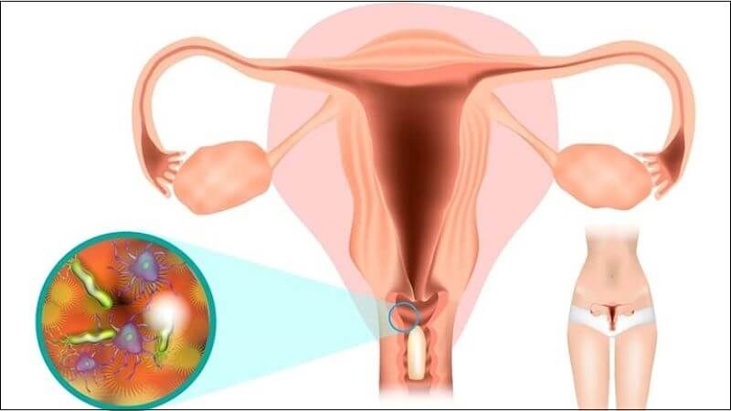 Nên làm gì khi quan hệ trong ngày đèn đỏ để an toàn tuyệt đối? Hướng dẫn chi tiết