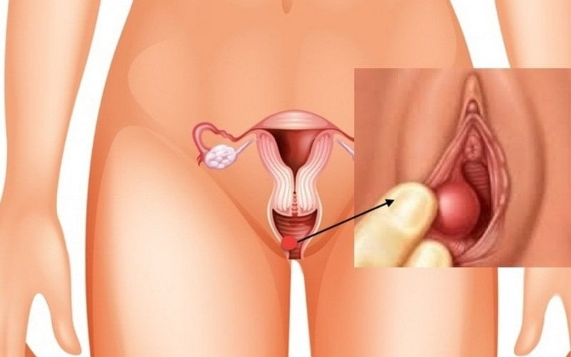 Tác Hại Của Phụ Nữ Khi Quan Hệ Quá Nhiều – Những Rủi Ro Sức Khỏe Không Thể Bỏ Qua