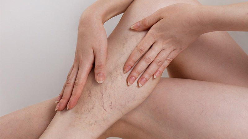 Nguyên Nhân Tình Trạng Tinh Trùng Yếu Thường Gặp Là Gì? Dấu Hiệu Và Cách Khắc Phục