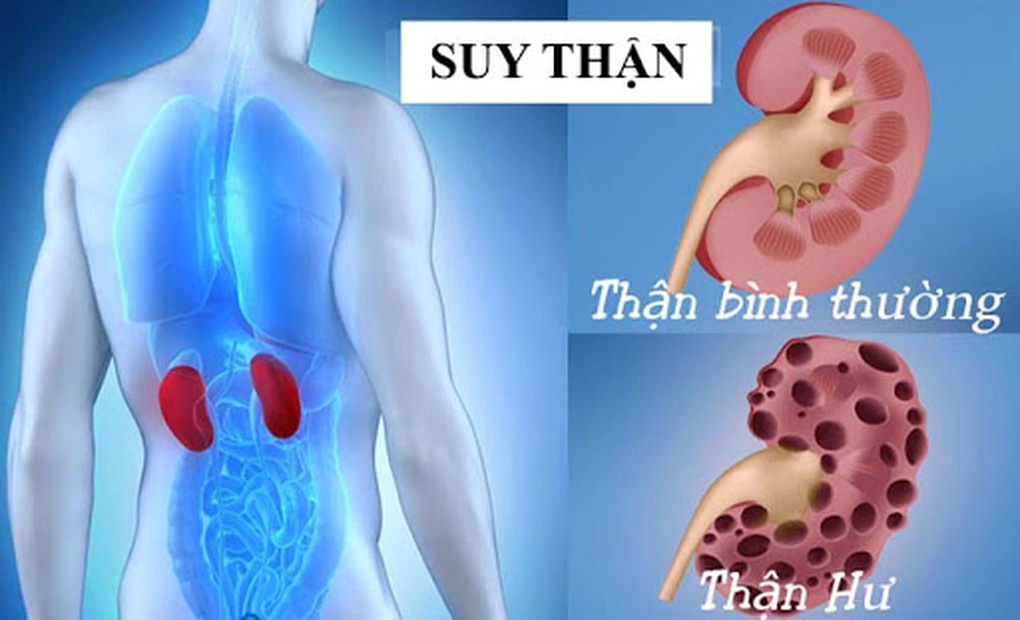 Thận Yếu Có Ảnh Hưởng Đến Sinh Lý Nam Không?