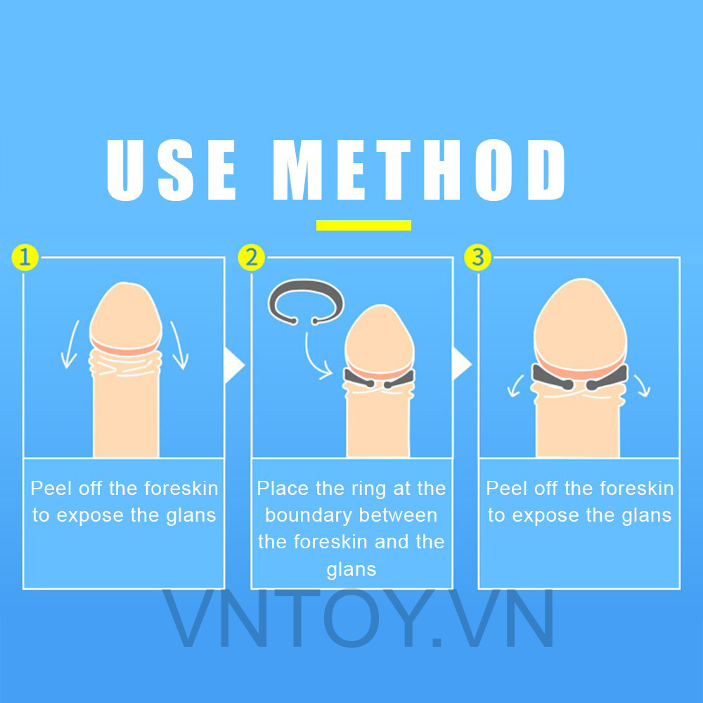 Vòng đeo đầu khấc ngày đêm điều trị xuất tinh sớm cho nam giới