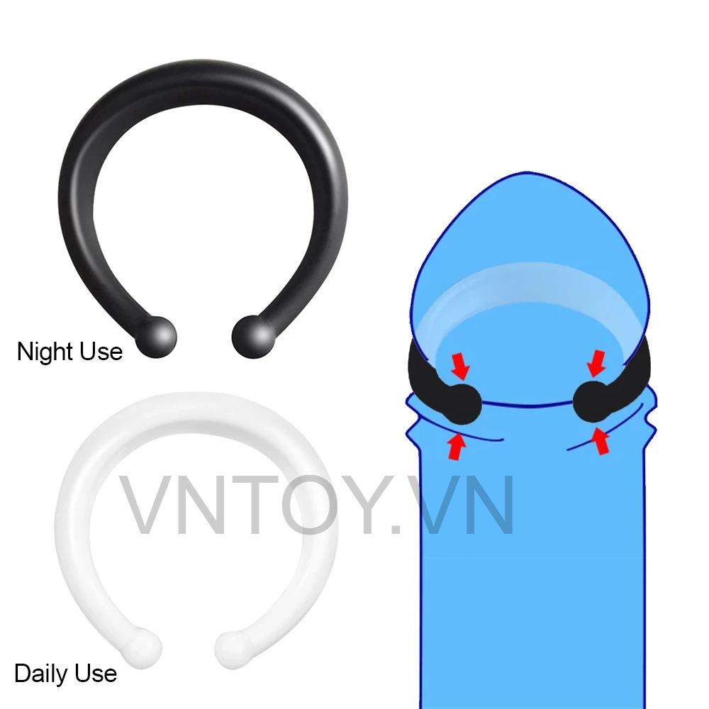 Vòng đeo đầu khấc ngày đêm điều trị xuất tinh sớm cho nam giới