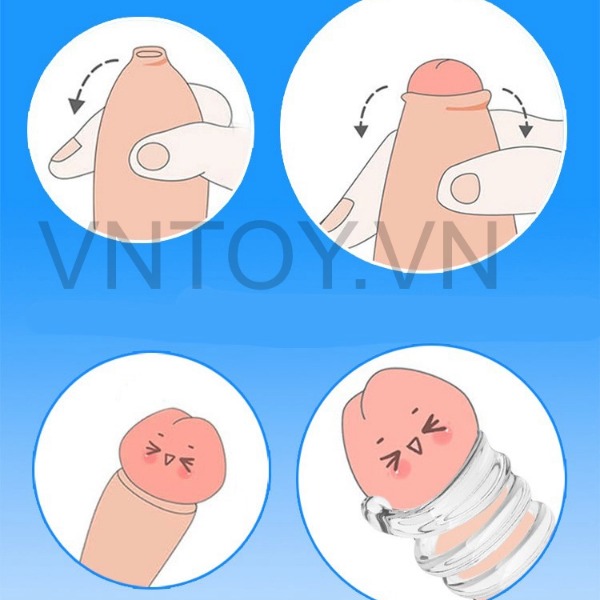 Vòng đeo kháng dương vật chống hẹp bao quy đầu