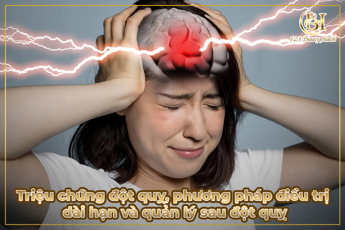 Triệu chứng đột quỵ, phương pháp điều trị dài hạn và quản lý sau đột quỵ