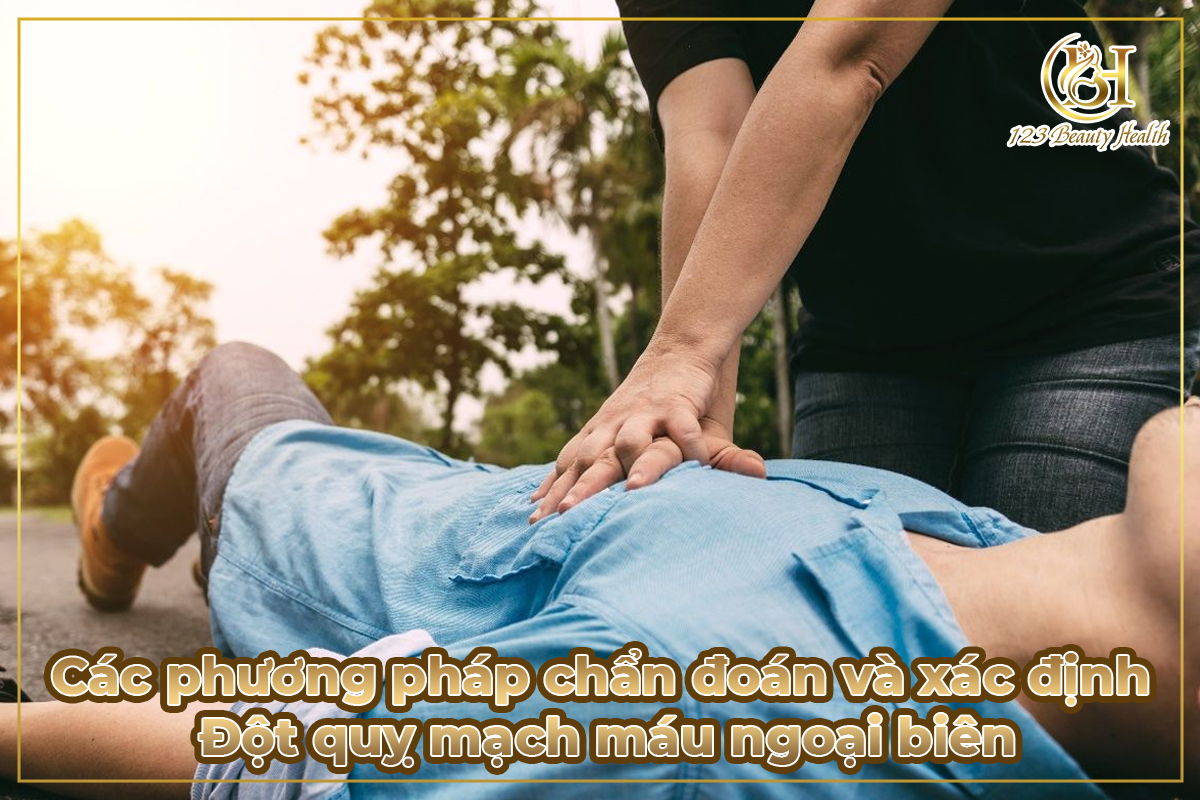 Các phương pháp chẩn đoán và xác định Đột quỵ mạch máu ngoại biên