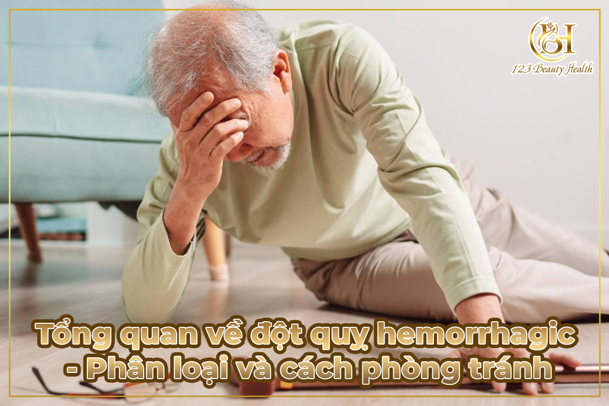Tổng quan về đột quỵ hemorrhagic - Phân loại và cách phòng tránh
