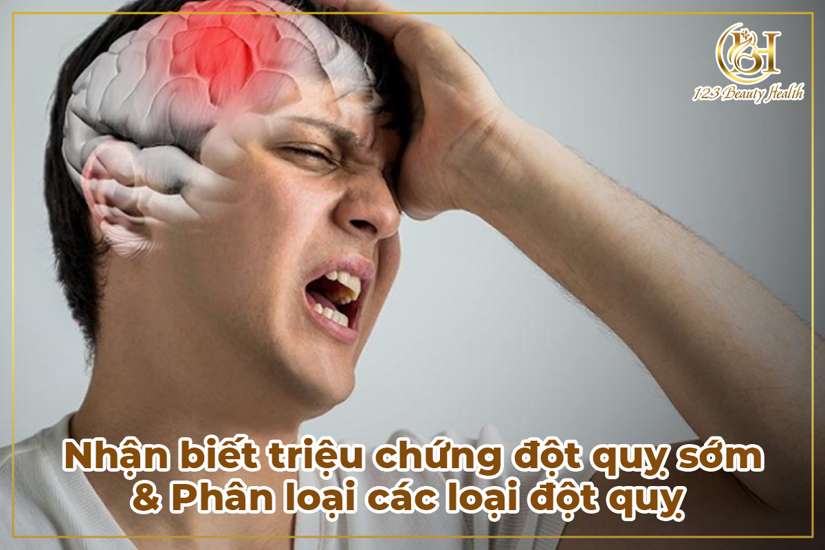 Nhận biết triệu chứng đột quỵ sớm & Phân loại các loại đột quỵ