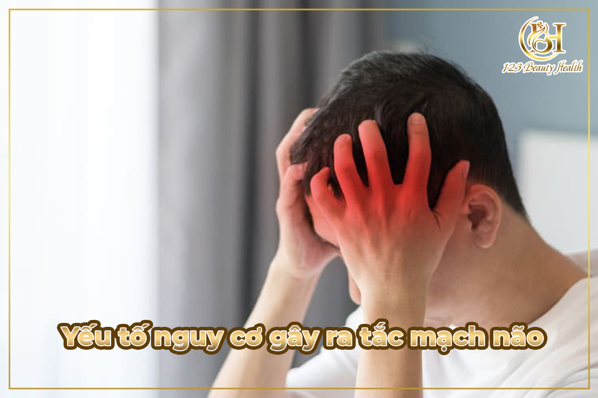 Yếu tố nguy cơ gây ra tắc mạch não