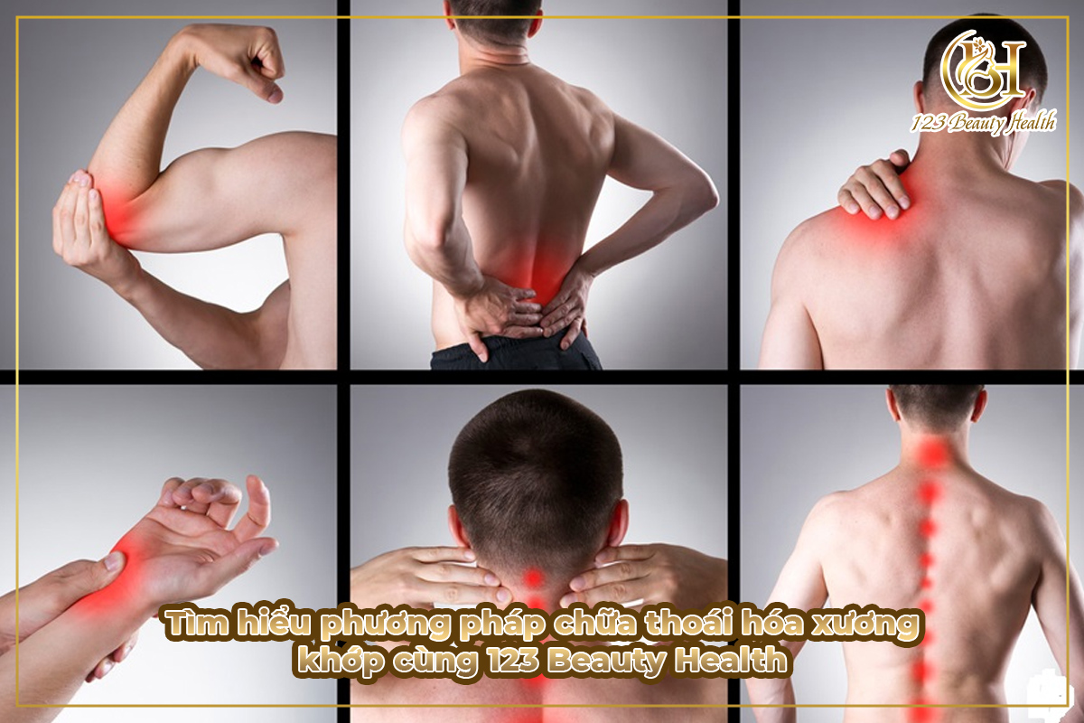 Tìm hiểu phương pháp chữa thoái hóa xương khớp cùng 123 Beauty Health