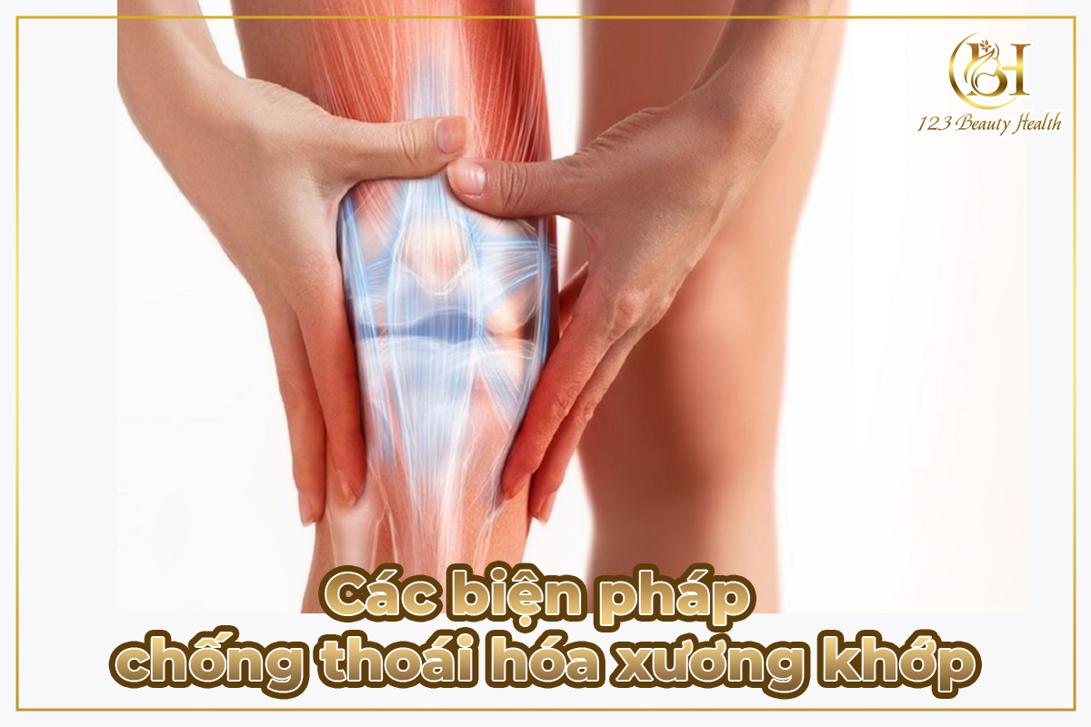Các biện pháp chống thoái hóa xương khớp