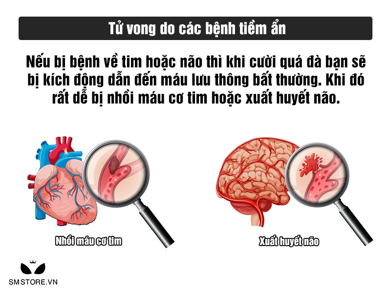 Cười quá đà có thể bị tử vong do các bệnh tiềm ẩn