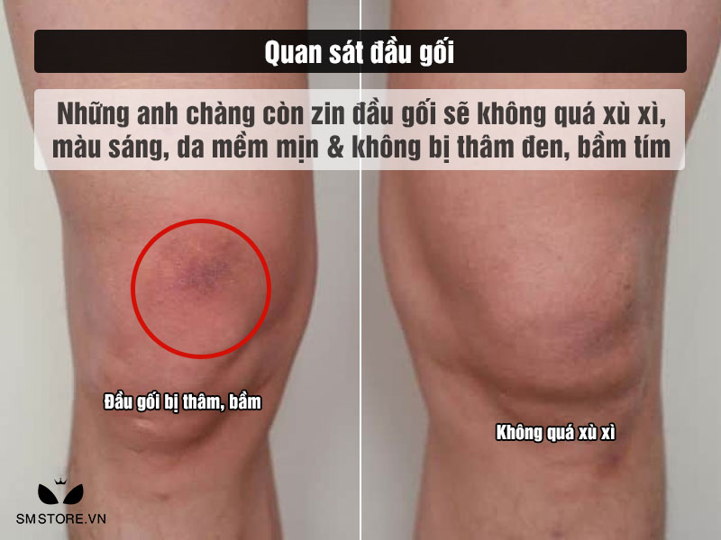 quan sát đầu gối nhận biết trai tân