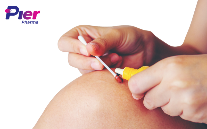 Cách Vệ Sinh và Băng Bó Vết Thương Đúng Kỹ Thuật, Giảm Đau, Ngừa Sẹo