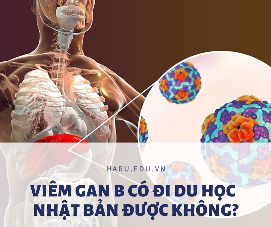 BỊ VIÊM GAN B THÌ CÓ ĐI NHẬT ĐƯỢC KHÔNG?