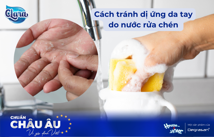 Giải Pháp Cho Làn Da Nhạy Cảm: Cách Tránh Dị Ứng Tay Khi Sử Dụng Nước Rửa Chén