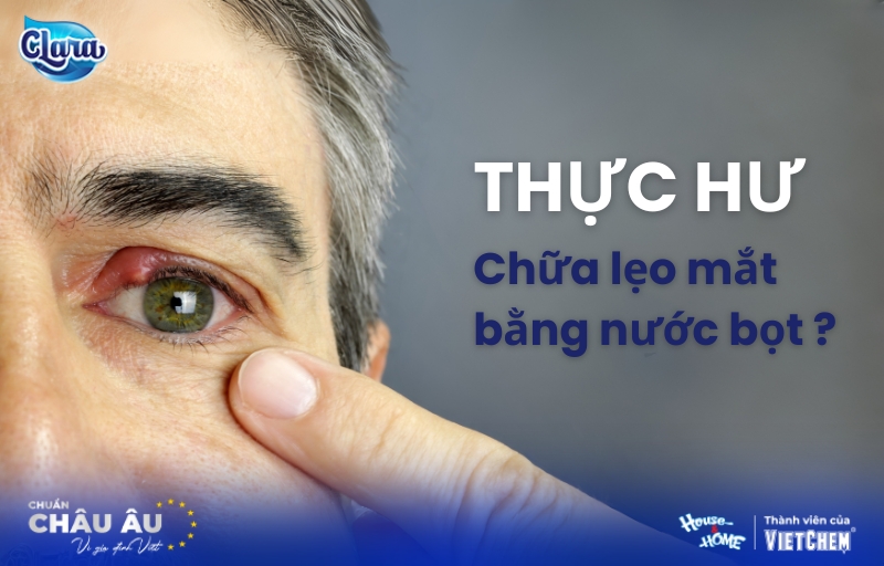 Mẹo chữa lẹo mắt bằng nước bọt? Thực hư đúng hay sai?