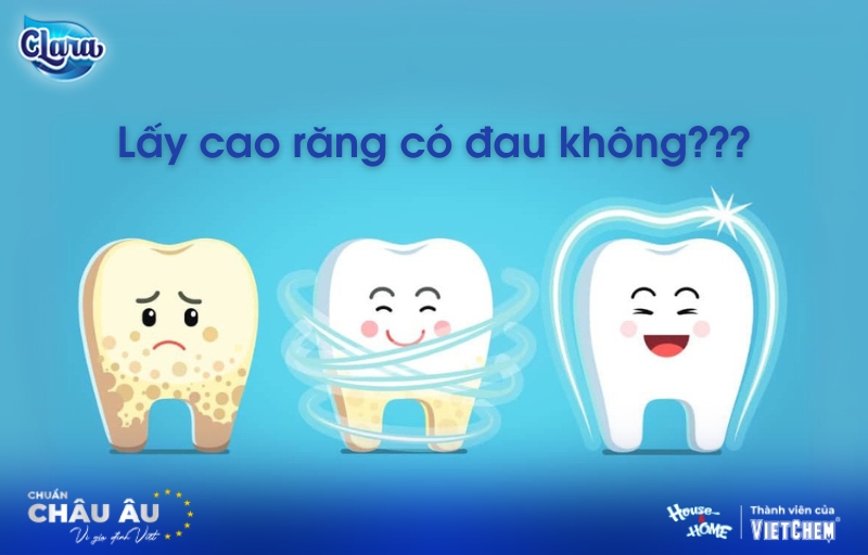 Lấy cao răng có đau không? Giải đáp từ chuyên gia nha khoa