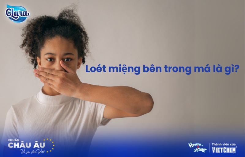 Loét miệng bên trong má là gì? Cách nhận biết và điều trị dứt điểm