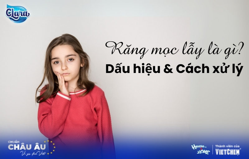 Răng mọc lẫy là gì? Dấu hiệu, cách xử lý và chăm sóc răng toàn diện cho bé