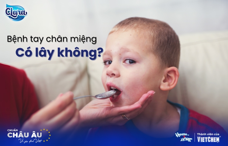 Tay chân miệng có lây không? Cơ chế lây, ai dễ mắc và cách phòng tránh hiệu quả
