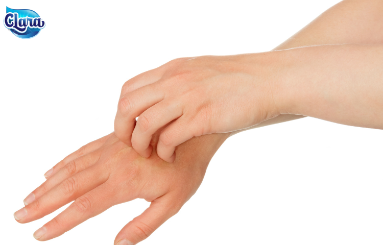 cặn nước rửa chén gây kích ứng da